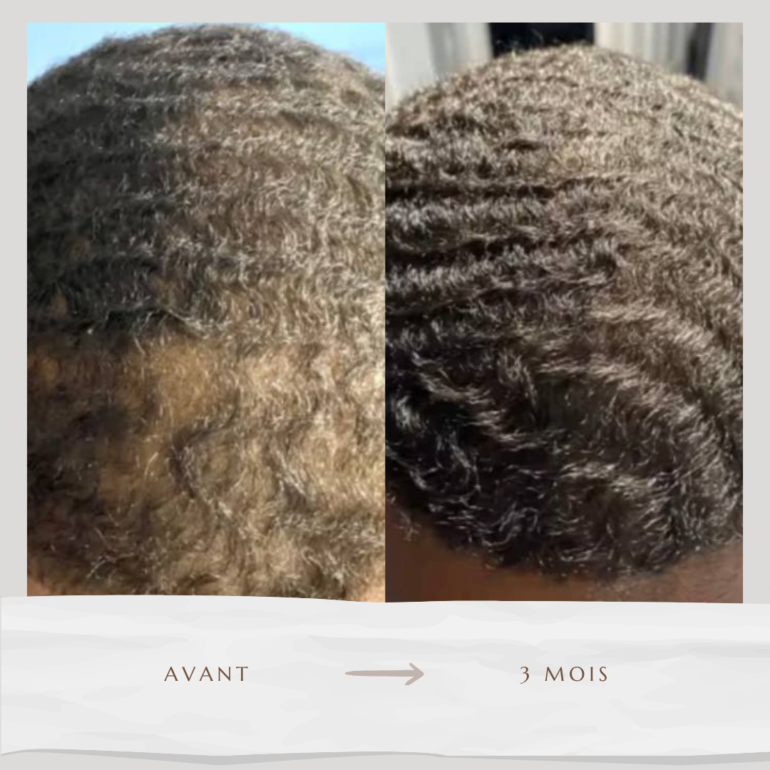 Sérum accélérateur de pousse (50ml)