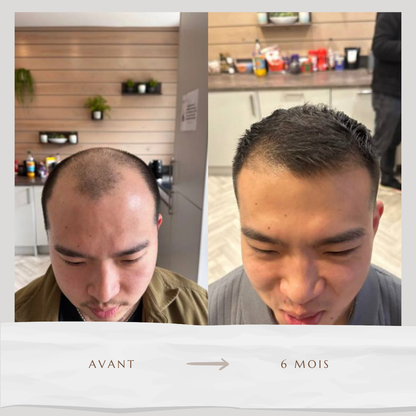 Sérum accélérateur de pousse (60ml)