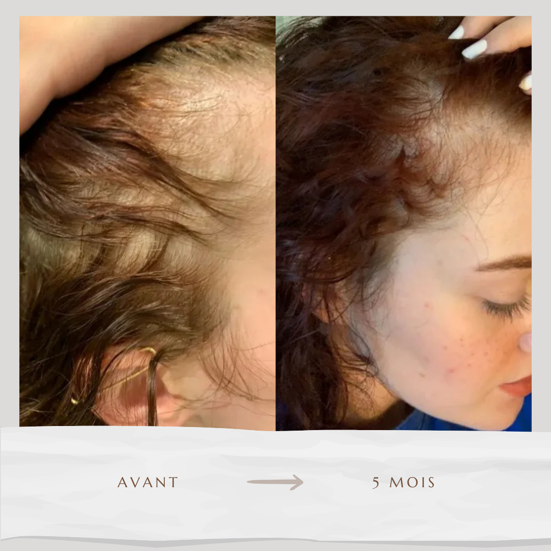 Sérum accélérateur de pousse (60ml)