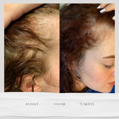 Sérum accélérateur de pousse (60ml)