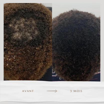 Sérum accélérateur de pousse (60ml)