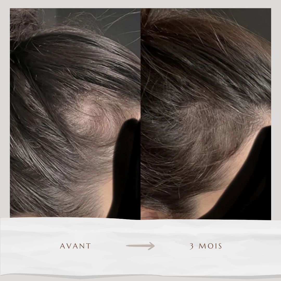 Sérum accélérateur de pousse (60ml)