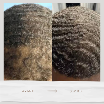 Sérum accélérateur de pousse (60ml)